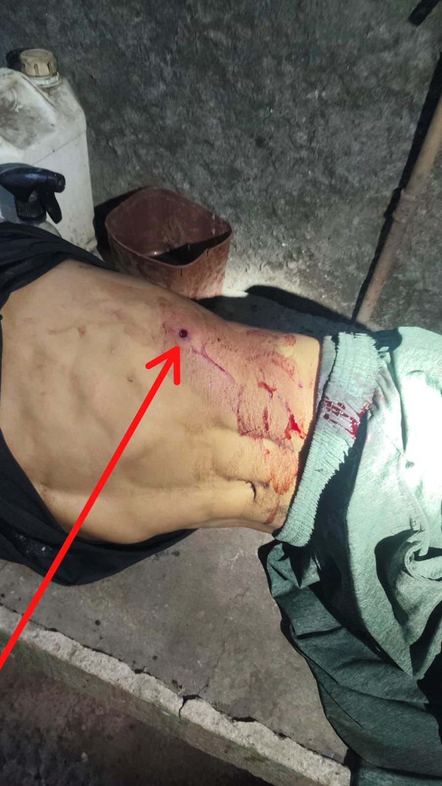 foto do Jovem baleado no Raiar do Sol