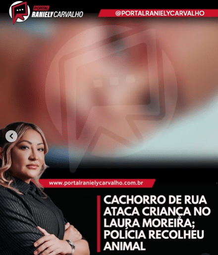 Criança atacada por cachorro no Laura Moreira