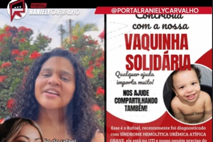 Síndrome Hemolítica Urêmica Atípica