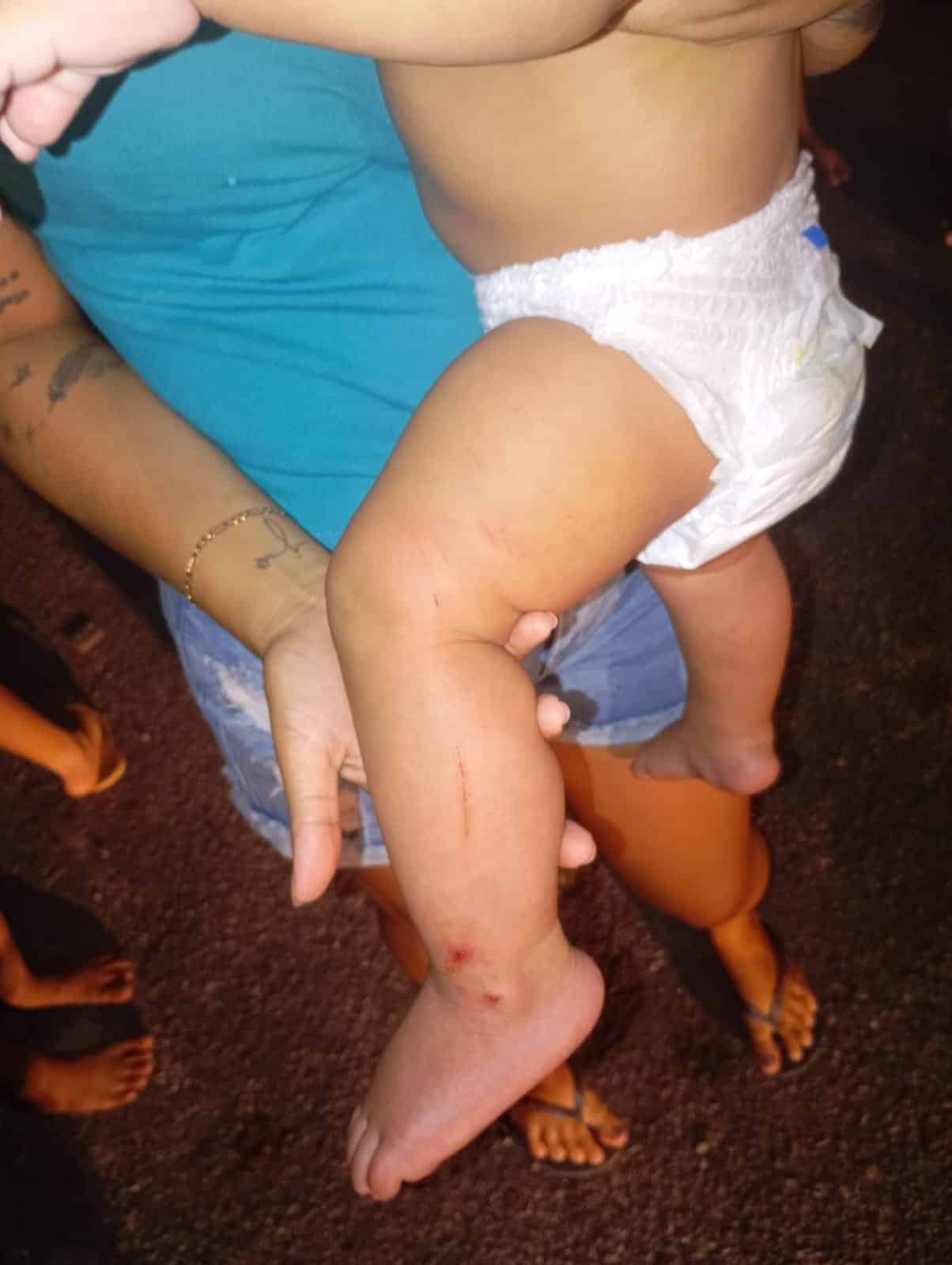 homem agride ex e fere bebê em Roraima